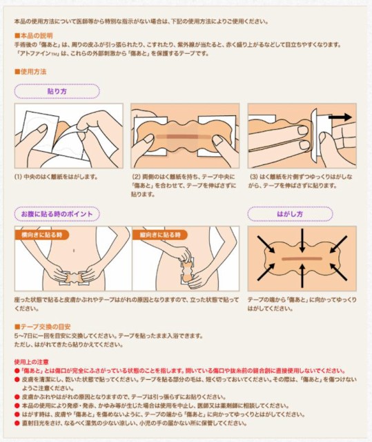 ニチバン アトファイン L 6枚 帝王切開 傷 テープ 手術後の傷あと 傷