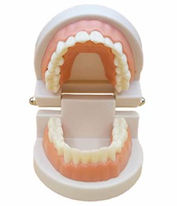 歯科模型 歯列模型 インプラント ブリッジ 差し歯 歯医者 研究 説明 教材 学習 用 (小型・ピンク)