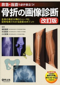 骨折の画像診断 救急・当直で必ず役立つ! 全身の骨折分類のシェーマと症例写真でわかる読影のポイント/福田国彦/丸毛啓史