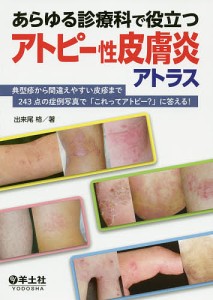 あらゆる診療科で役立つアトピー性皮膚炎アトラス 典型疹から間違えやすい皮疹まで243点の症例写真で「これってアトピー?」に答える