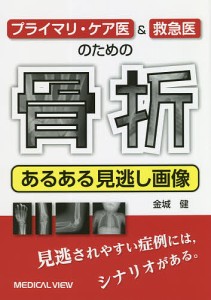 プライマリ・ケア医&救急医のための骨折あるある見逃し画像/金城健