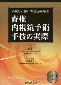 イラスト・術中写真から学ぶ脊椎内視鏡手術手技の実際/水野順一/西村泰彦