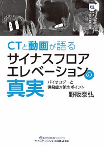 CTと動画が語るサイナスフロアエレベーションの真実 バイオロジーと併発症対策のポイント/野阪泰弘