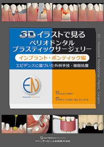 3Dイラストで見るペリオドンタルプラスティックサージェリー インプラント・ポンティック編/中田光太郎/著木林博之/著岡田素平太