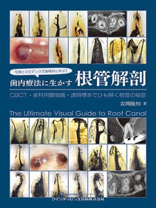 写真とエビデンスで歯種別に学ぶ!歯内療法に生かす根管解剖 CBCT・歯科用顕微鏡・透明標本でひも解く根管の秘密/吉岡隆知