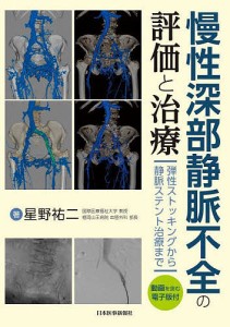 慢性深部静脈不全の評価と治療 弾性ストッキングから静脈ステント治療まで/星野祐二