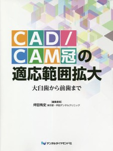 CAD/CAM冠の適応範囲拡大 大臼歯から前歯まで/坪田有史