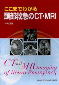 ここまでわかる頭部救急のCT・MRI/井田正博