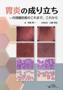 胃炎の成り立ち 内視鏡診断のこれまで、これから/寺尾秀一