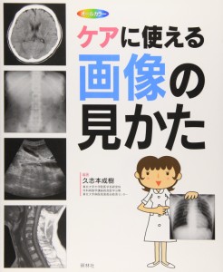 ケアに使える画像の見かた—X線写真・CT画像・エコー像・MRI(中古品)