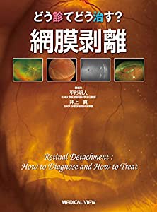 どう診て どう治す? 網膜剥離(中古品)