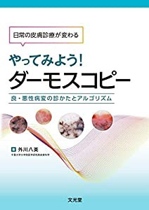 日常の皮膚診療が変わる やってみよう! ダーモスコピー(中古品)