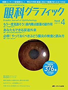 眼科グラフィック 2017年4号(第6巻4号)特集:もう一度見直そう! 緑内障点眼薬の副作用 / あなたもできる涙道外来 / 必修! やって 