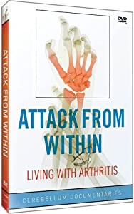 Attack From Within: Living With Arthritis [DVD](中古品)