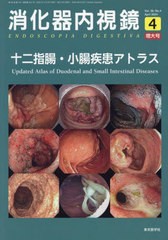 [書籍とのメール便同梱不可]送料無料有/[書籍]/消化器内視鏡 Vol.36No.4増大号(2024April)/「消化器内視鏡」編集/NEOBK-2974155