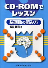 [書籍]/CD-ROMでレッスン脳画像の読み方/石原健司/著/NEOBK-892476