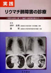 [書籍]/実践リウマチ肺障害の診療 実際の症例に基づく胸部X線読影診断のポイント/田中良哉/編集 迎寛/編集 田中良哉/著 迎寛/著 齋藤和義