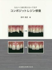 [書籍のメール便同梱は2冊まで]送料無料有/[書籍]/コンポジットレジン修復 (なるべく歯を削らないで治す)/田代浩史/著/NEOBK-2223063