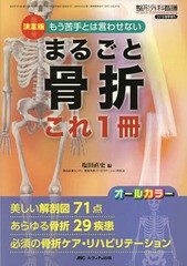 [書籍]/まるごと骨折これ1冊 決定版!もう苦手とは言わせない 美しい解剖図71点あらゆる骨折29疾患必須の骨折ケア・リハビリテーション オ