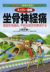 [書籍のメール便同梱は2冊まで]/[書籍]/スーパー図解坐骨神経痛 原因を見極め、不快な症状を解消する (トップ専門医の「家庭の医学」シリ