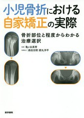 [書籍とのメール便同梱不可]送料無料/[書籍]/小児骨折における自家矯正の実際 骨折部位と程度からわかる治療選択/亀ケ谷真琴/執筆/NEOBK-