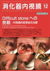 [書籍]/消化器内視鏡 Vol.27No.12(2015December)/消化器内視鏡編集委員会/編集/NEOBK-1903602