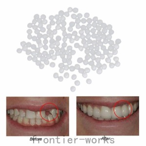 サーマルビーズ歯ベニア成形可能義歯仮歯修復ツールg