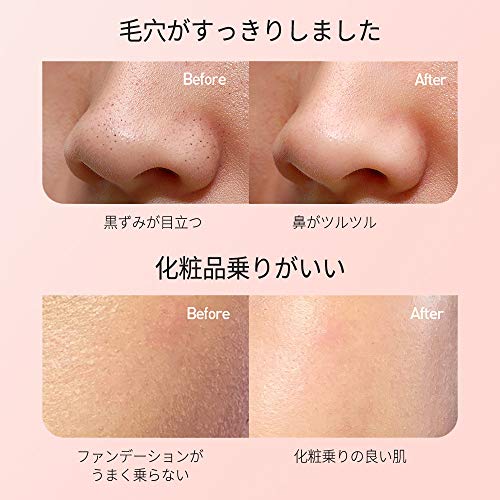 配送無料 毛穴吸引器 毛穴クリーナー 美顔器 Tenntou 毛穴ケア ニキビ 黒ずみ吸出 6つの吸引ノズル イチゴ鼻 角栓 ケア シワ ほうれいの通販はau Pay マーケット マイハニーハント