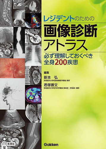 レジデントのための画像診断アトラス 必ず理解しておくべき全身200疾患/新本弘/君塚善文