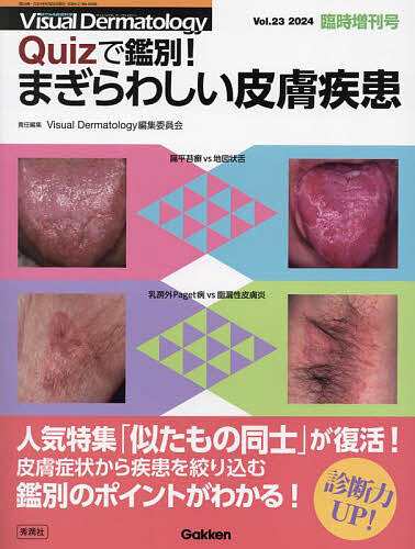 Quizで鑑別!まぎらわしい皮膚疾患/ＶｉｓｕａｌＤｅｒｍａｔｏｌｏｇｙ編集委員会の通販は