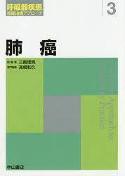 肺癌