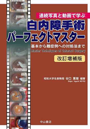 白内障手術パーフェクトマスター 連続写真と動画で学ぶ 基本から難症例への対処法まで/谷口重雄