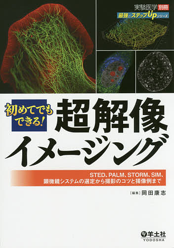 初めてでもできる!超解像イメージング STED、PALM、STORM、SIM、顕微鏡システムの選定から撮影のコツと撮像例までの通販は