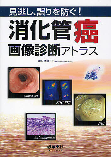 見逃し、誤りを防ぐ！消化管癌画像診断アトラス/武藤学