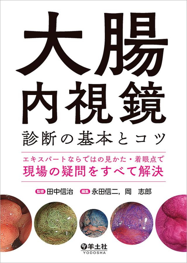 大腸内視鏡診断の基本とコツ エキスパートならではの見かた・着眼点で現場の疑問をすべて解決/田中信治/永田信二/岡志郎