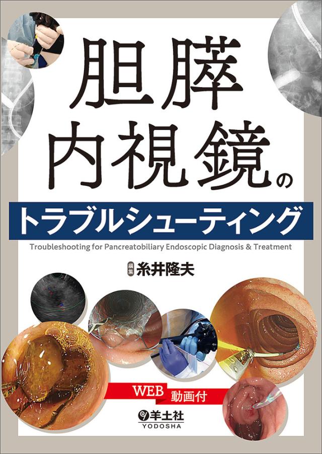 ジャイアンツ 京本眞 スーパーレア オータムver ガチャ サコッシュ