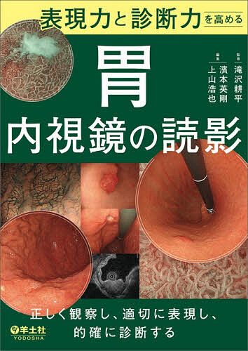 表現力と診断力を高める胃内視鏡の読影 正しく観察し、適切に表現し、的確に診断する/滝沢耕平/濱本英剛/上山浩也