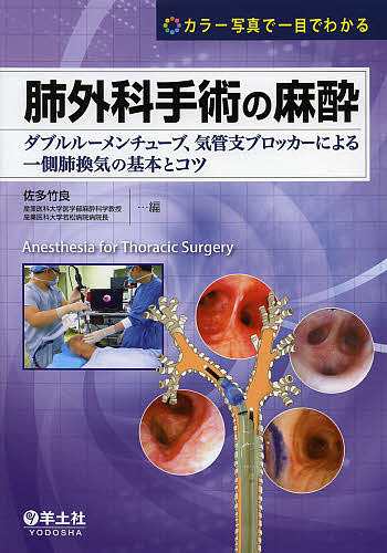 肺外科手術の麻酔 ダブルルーメンチューブ、気管支ブロッカーによる一側肺換気の基本とコツ カラー写真で一目でわかる/佐多竹良