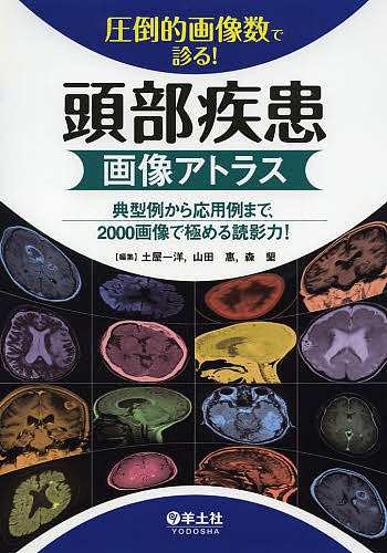 圧倒的画像数で診る!頭部疾患画像アトラス 典型例から応用例まで、2000画像で極める読影力!/土屋一洋/山田惠/森墾