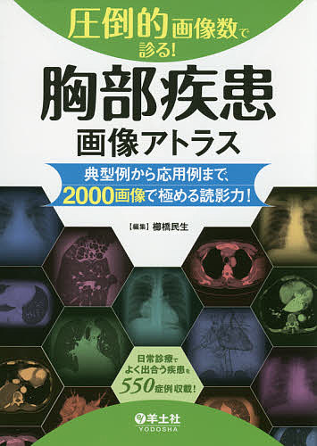 圧倒的画像数で診る!胸部疾患画像アトラス 典型例から応用例まで、2000画像で極める読影力!/櫛橋民生
