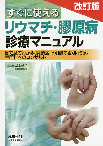 すぐに使えるリウマチ・膠原病診療マニュアル 目で見てわかる、関節痛・不明熱の鑑別、治療、専門科へのコンサルト/岸本暢将