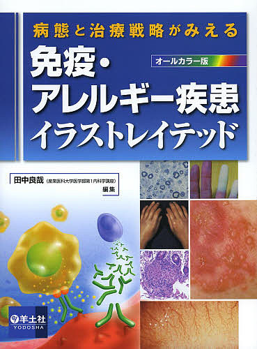 免疫・アレルギー疾患イラストレイテッド 病態と治療戦略がみえる/田中良哉の通販は 6,732円