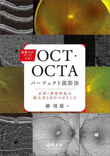 診断力がアップする!OCT・OCTAパーフェクト読影法 正常・異常