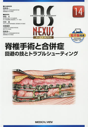 脊椎手術と合併症 回避の技とトラブルシューティング/西良浩一