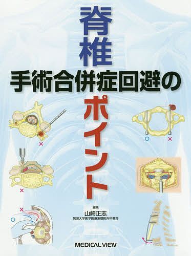 脊椎手術合併症回避のポイント/山崎正志 【公式通販】