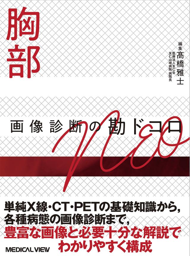 胸部画像診断の勘ドコロNEO/高橋雅士