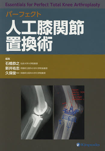 パーフェクト人工膝関節置換術/石橋恭之/新井祐志/久保俊一