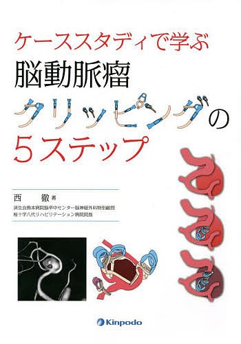 ケーススタディで学ぶ脳動脈瘤クリッピングの5ステップ/西徹の通販は