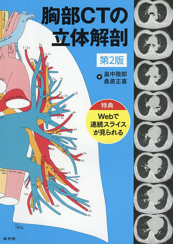 胸部CTの立体解剖/畠中陸郎/桑原正喜