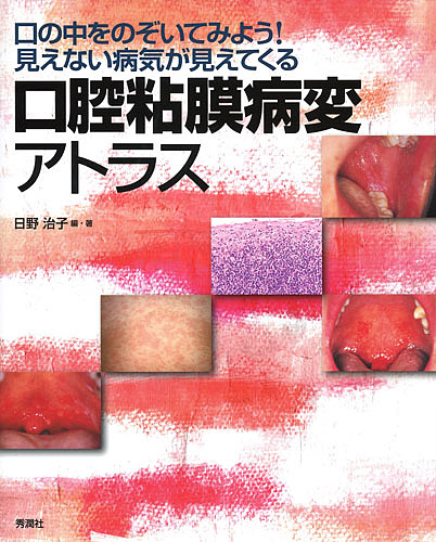 口腔粘膜病変アトラス 口の中をのぞいてみよう!見えない病気が見えてくる/日野治子